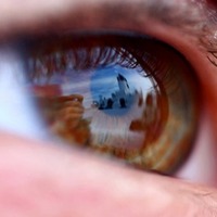 İlk retina nakli yapıldı!