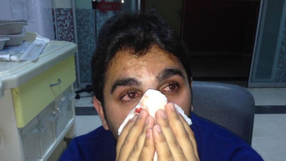 Trafik magandaları ambulans şoförünün burnunu kırdı