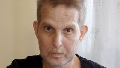 Ameliyatlardan sonra rengi "sarardı"