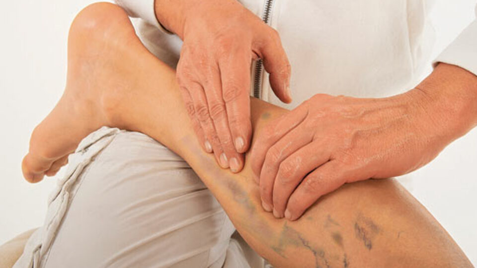 Varisi, "baldır kası" egzersiziyle önleyin