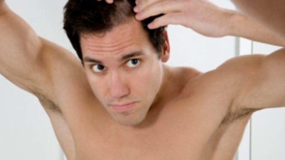 Erkeklik hormonu saçları döküyor