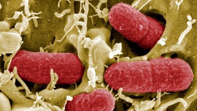 MERS Virüsü nedir?