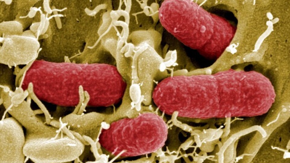 MERS Virüsü nedir?