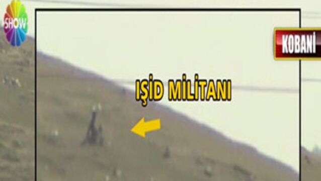 İşte yaralı IŞİD militanları!