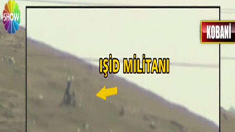 İşte yaralı IŞİD militanları!