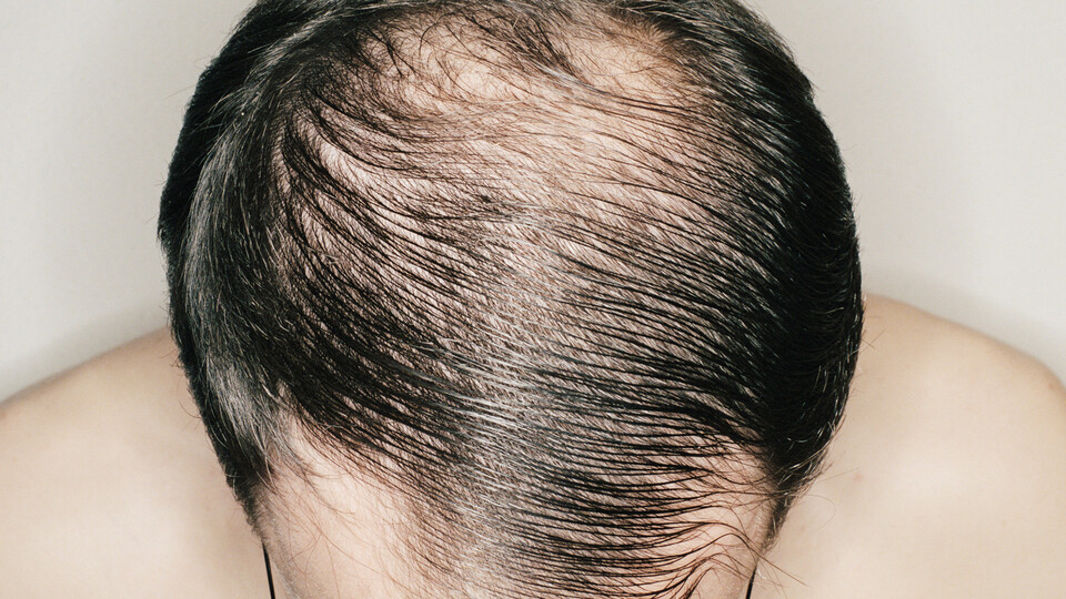 Kelliği sonbaharda durdurun