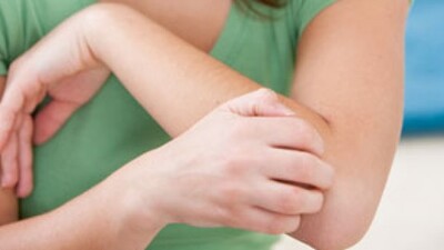 "Sedef hastalığının çaresi aktarda değil"