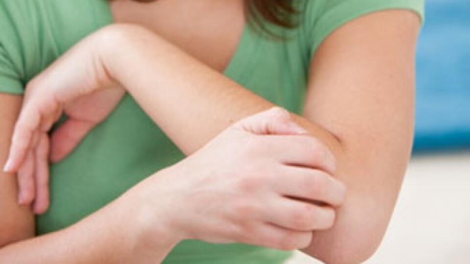 "Sedef hastalığının çaresi aktarda değil"