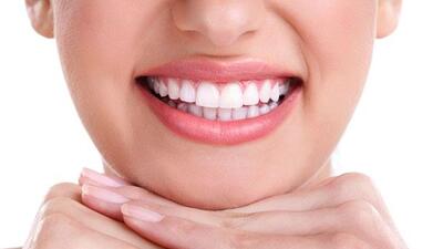 Diş kusurları kabusunuz olmasın!