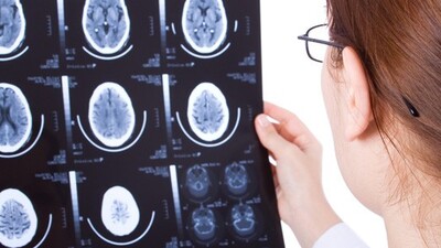 Uzmanlardan 'tomografi' uyarısı