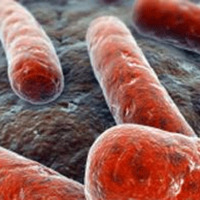 Lejyoner hastalığı Portekiz'de 5 can aldı