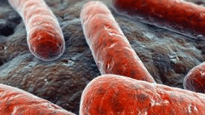 Lejyoner hastalığı Portekiz'de 5 can aldı