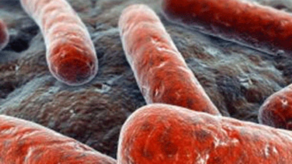 Lejyoner hastalığı Portekiz'de 5 can aldı