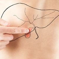 "Safra taşı ölümcül olabilir"