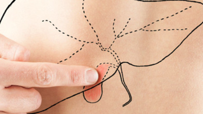 "Safra taşı ölümcül olabilir"