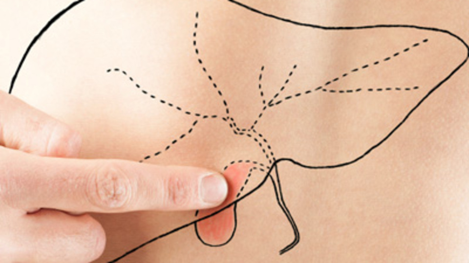 "Safra taşı ölümcül olabilir"