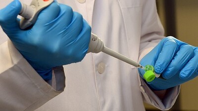 AIDS tarihe karışabilir