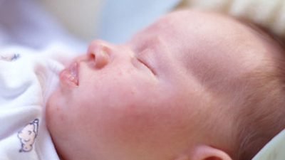 Bebeklerde gıda alerjisine dikkat