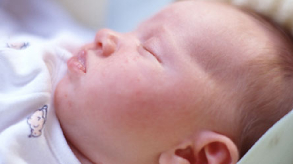 Bebeklerde gıda alerjisine dikkat