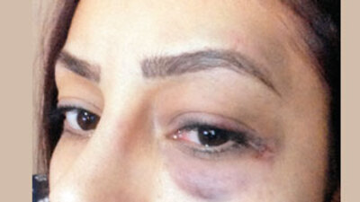 'Nil Burak'ın oğlu beni yumrukladı'