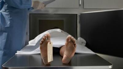 40-79 yaş arası kadınlar en çok bu yüzden ölüyor!