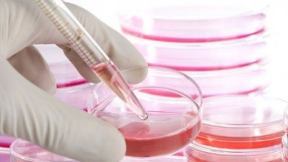 Kemoterapinin yerini kök hücre tedavisi alacak