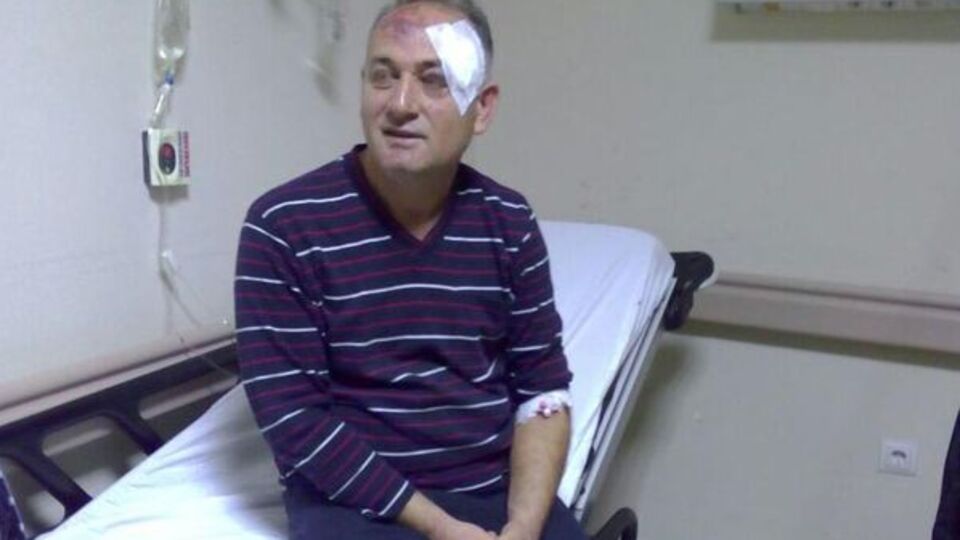 Belediye başkanı darbedildi