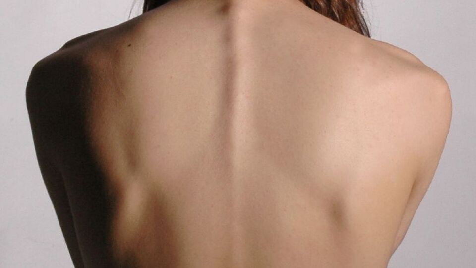 Omurga eğriliğine dikkat