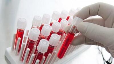 Kan testiyle menopoza girip girmediğinizi öğrenin