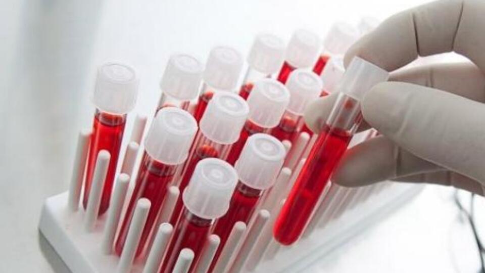 Kan testiyle menopoza girip girmediğinizi öğrenin