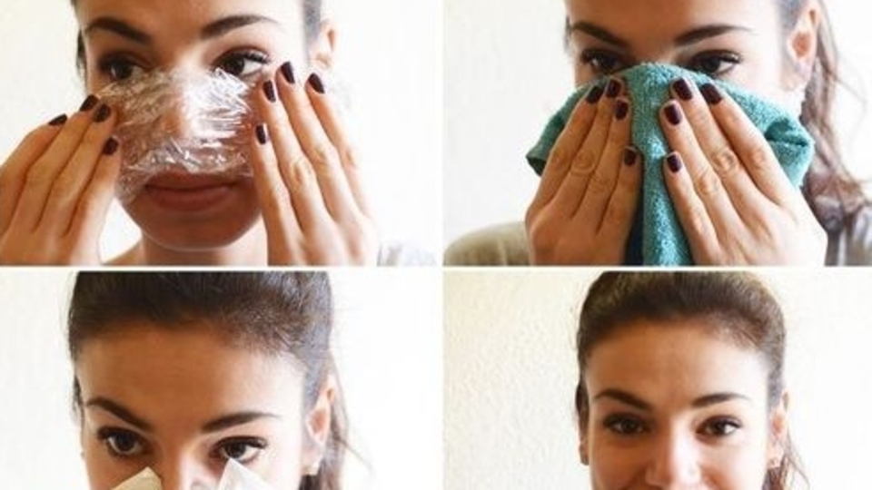 Siyah noktalara da vazelin!