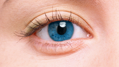 Gözünüz bir çok hastalığı ele veriyor!