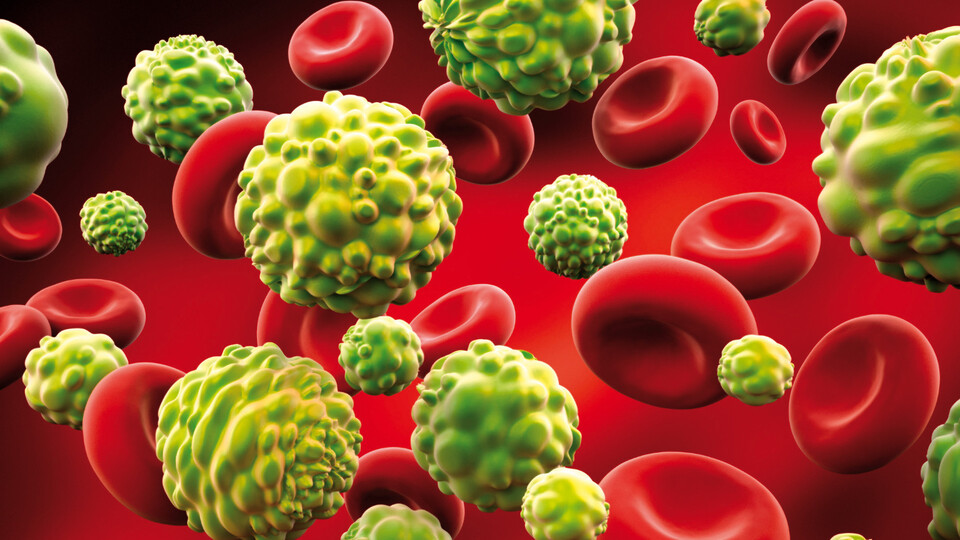 Kanserde korkutan tablo