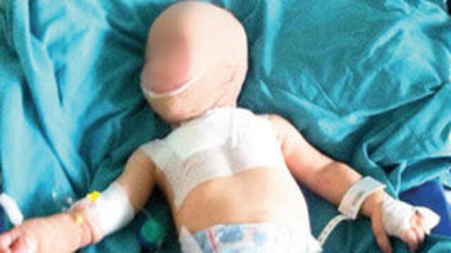 İşkence gören bebek devlet korumasında