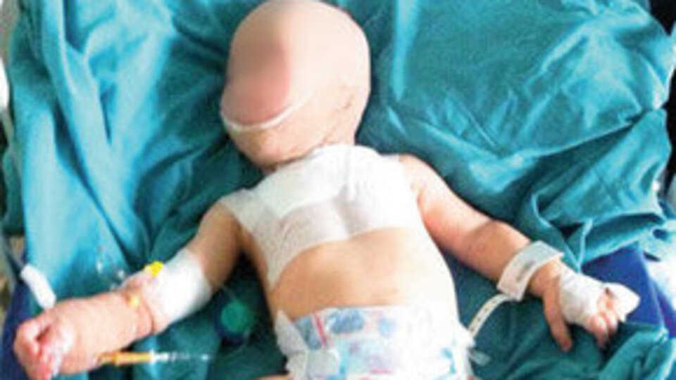 İşkence gören bebek devlet korumasında