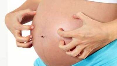 Hamilelik kaşıntıları çözümsüz değil