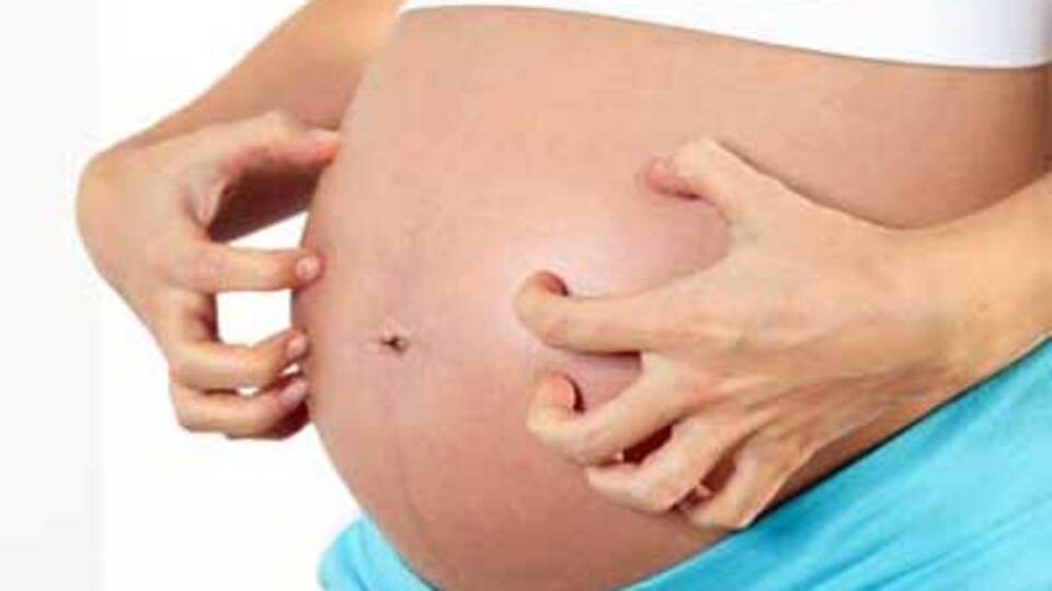 Hamilelik kaşıntıları çözümsüz değil