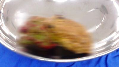 Midesinden 18 santimetrelik taş çıkartıldı