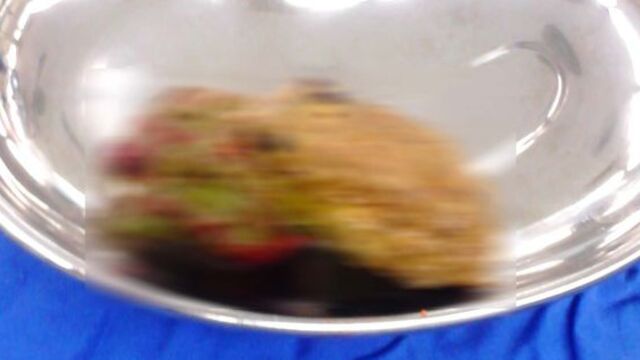 Midesinden 18 santimetrelik taş çıkartıldı