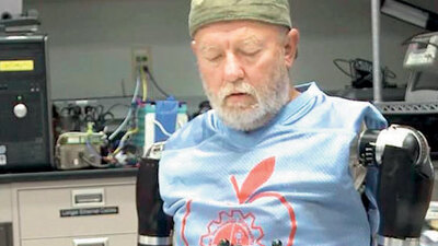 Düşünce gücüyle kollarını oynattı