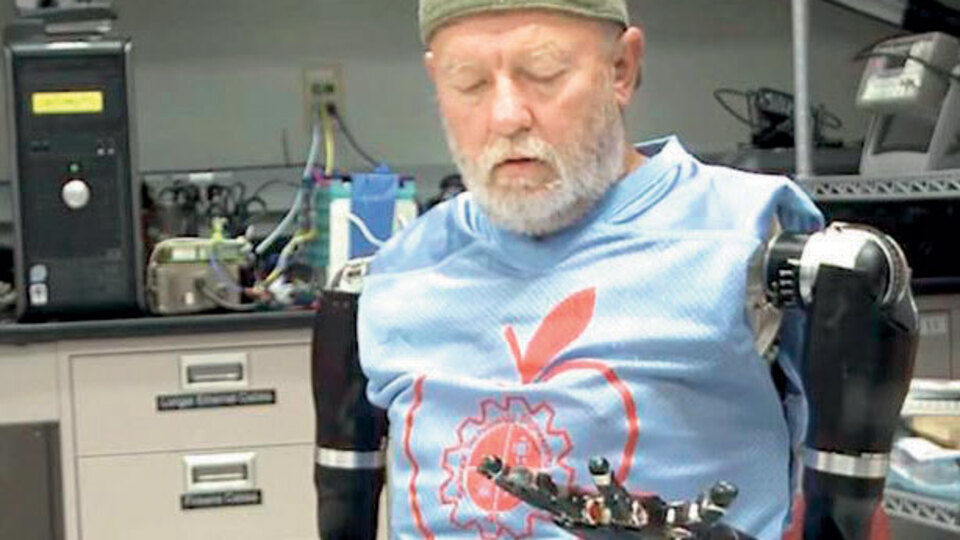 Düşünce gücüyle kollarını oynattı