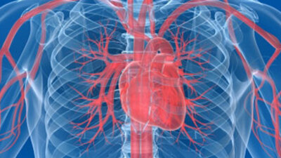 Stent sonrası 6 aya dikkat!