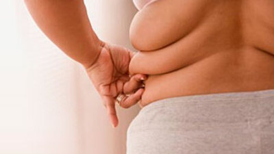 "Obezite'de ilk seçenek ameliyat değil"