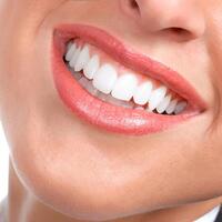 Evde diş beyazlatma yöntemleri