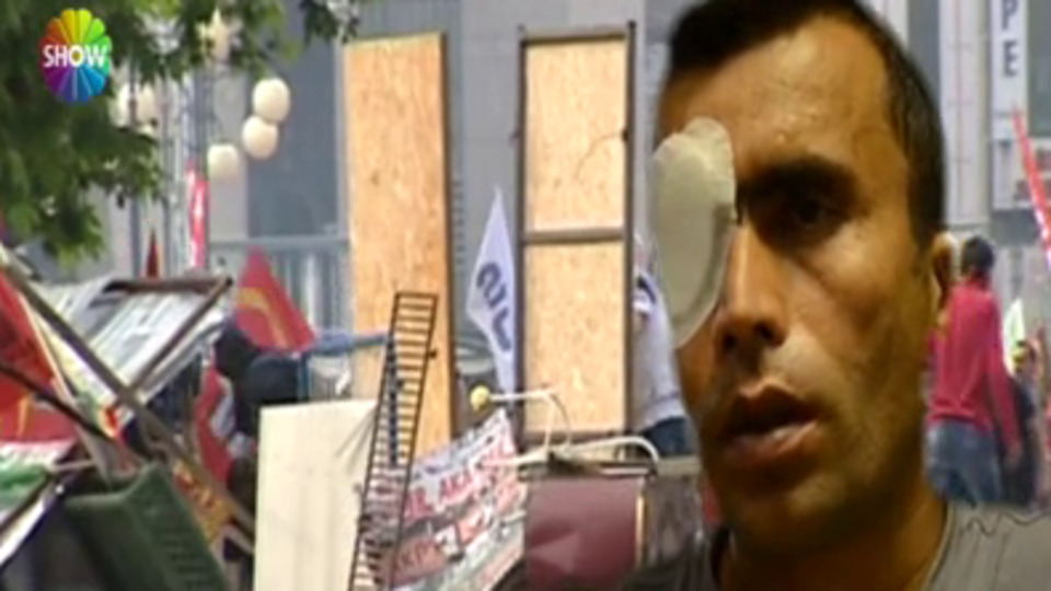 Kör oldu, Bakanlık "Tedbir alsaydın" dedi