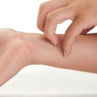 Kaşıntı deyip geçmeyin!