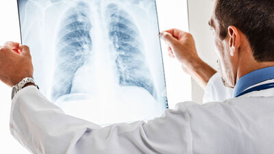 KOAH'a karşı sarımsak ve zencefille korunun