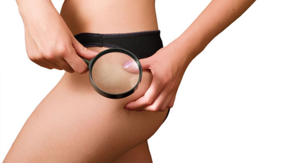 Selülit kabusunuz olmasın!