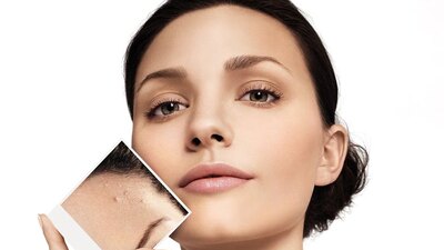 Bu yanlışlar cildi bozuyor!