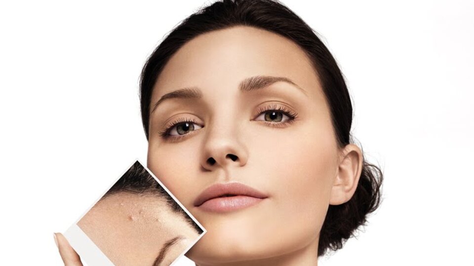 Bu yanlışlar cildi bozuyor!